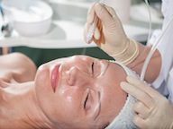Woman having jet peeling facial treatment